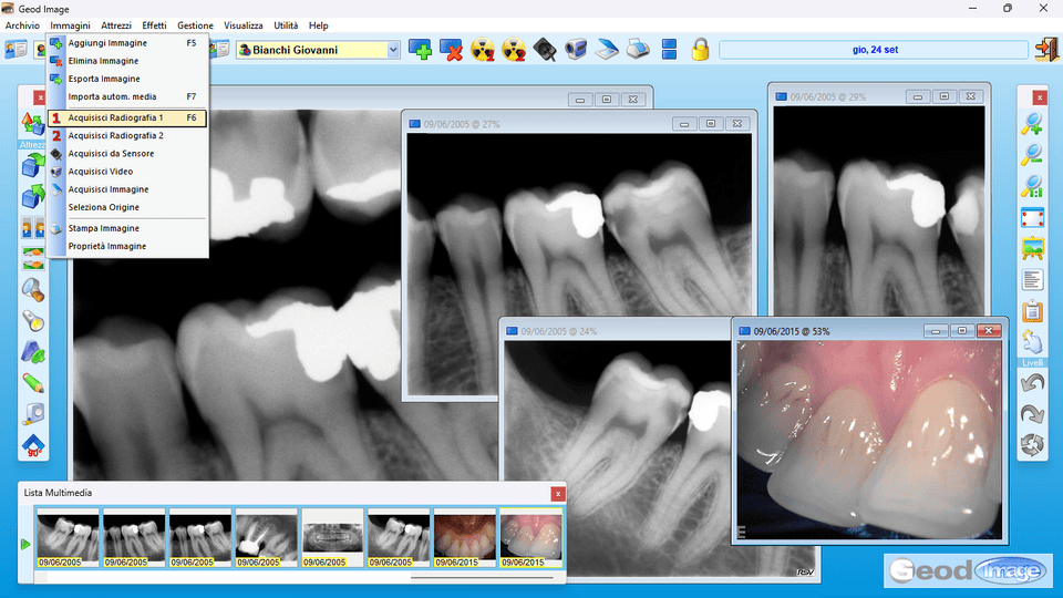 Acquisizione di radiografie e immagini